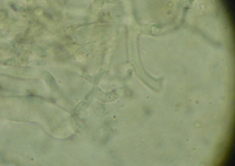 da determinare (Laeticorticium roseum)